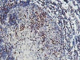 PDSS2 / DLP1 Antibody (clone OTI1D6)