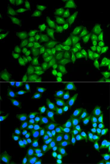 DAO / D Amino Acid Oxidase Antibody