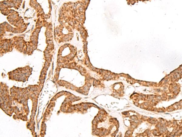 GBGT1 Antibody