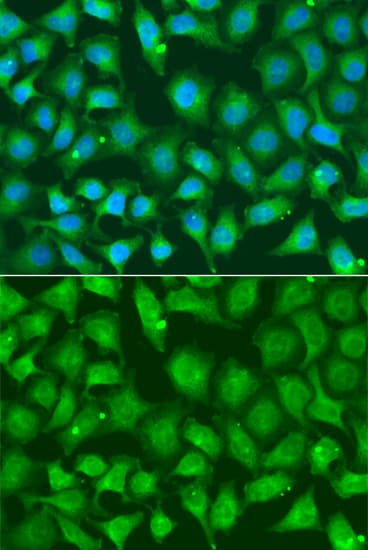 XRCC2 Antibody