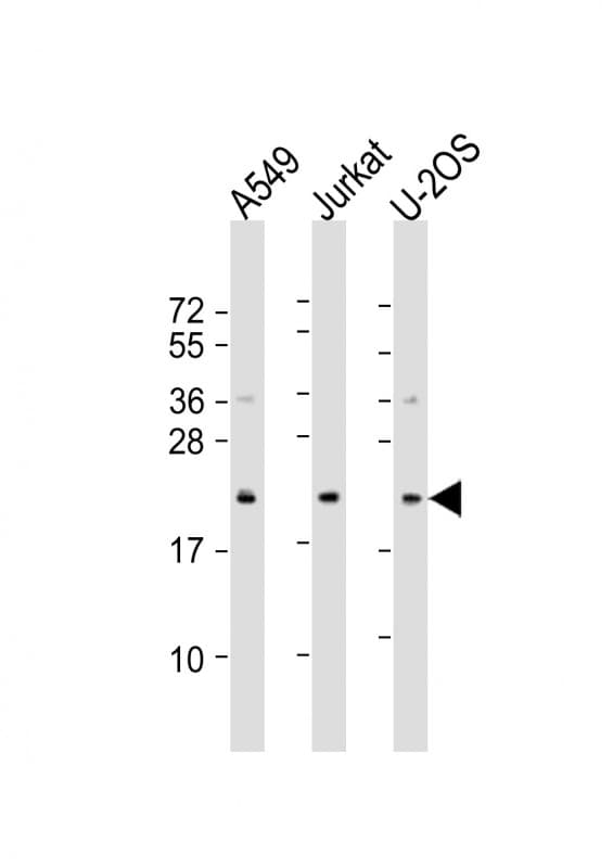 Polyclonal Rabbit anti-Human FAAP24 Antibody (aa1-32, WB)