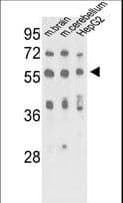 MECP2 Antibody (Ser421)