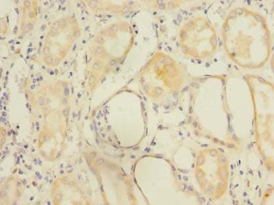 ZDHHC6 Antibody