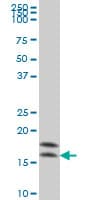 NME2 Antibody (clone 1D3)