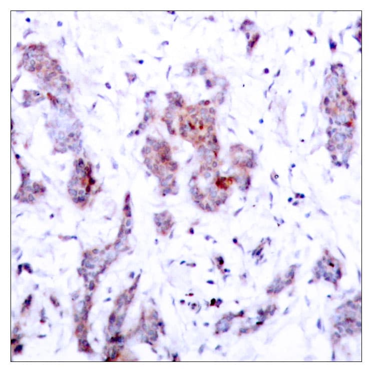 REL / C-Rel Antibody (aa470-519)
