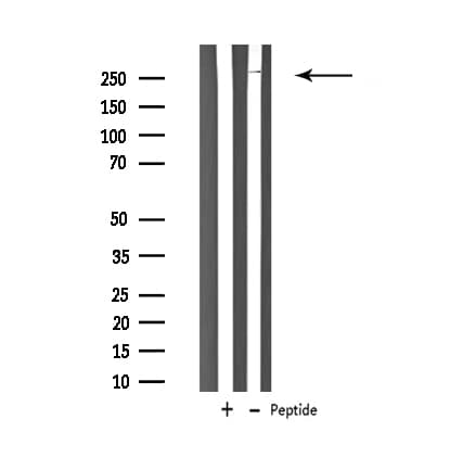 CACNA1H / Cav3.2 Antibody