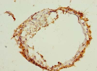 ARMCX2 Antibody