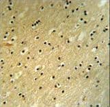 BCOR Antibody (aa1107-1137)