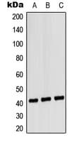 Polyclonal Rabbit anti-Human CXCR1 Antibody (Internal, WB)