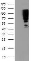 Monoclonal Mouse anti-Human SERPINB13 / HUR7 Antibody (clone OTI1B12, WB)