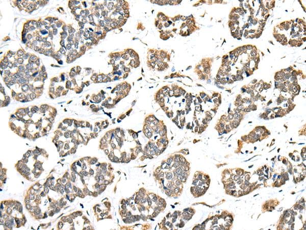 EEF1E1 / AIMP3 Antibody