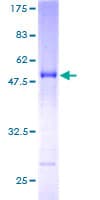 Human SNX27 Protein (Recombinant GST)