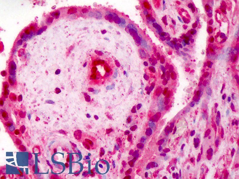 IHC-plus™ Polyclonal Rabbit anti-Human RBX1 / ROC1 Antibody (aa94-108, IHC, WB)