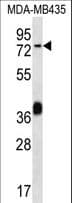 Polyclonal Rabbit anti-Human CEL / Carboxyl Ester Lipase Antibody (aa454-482, WB)