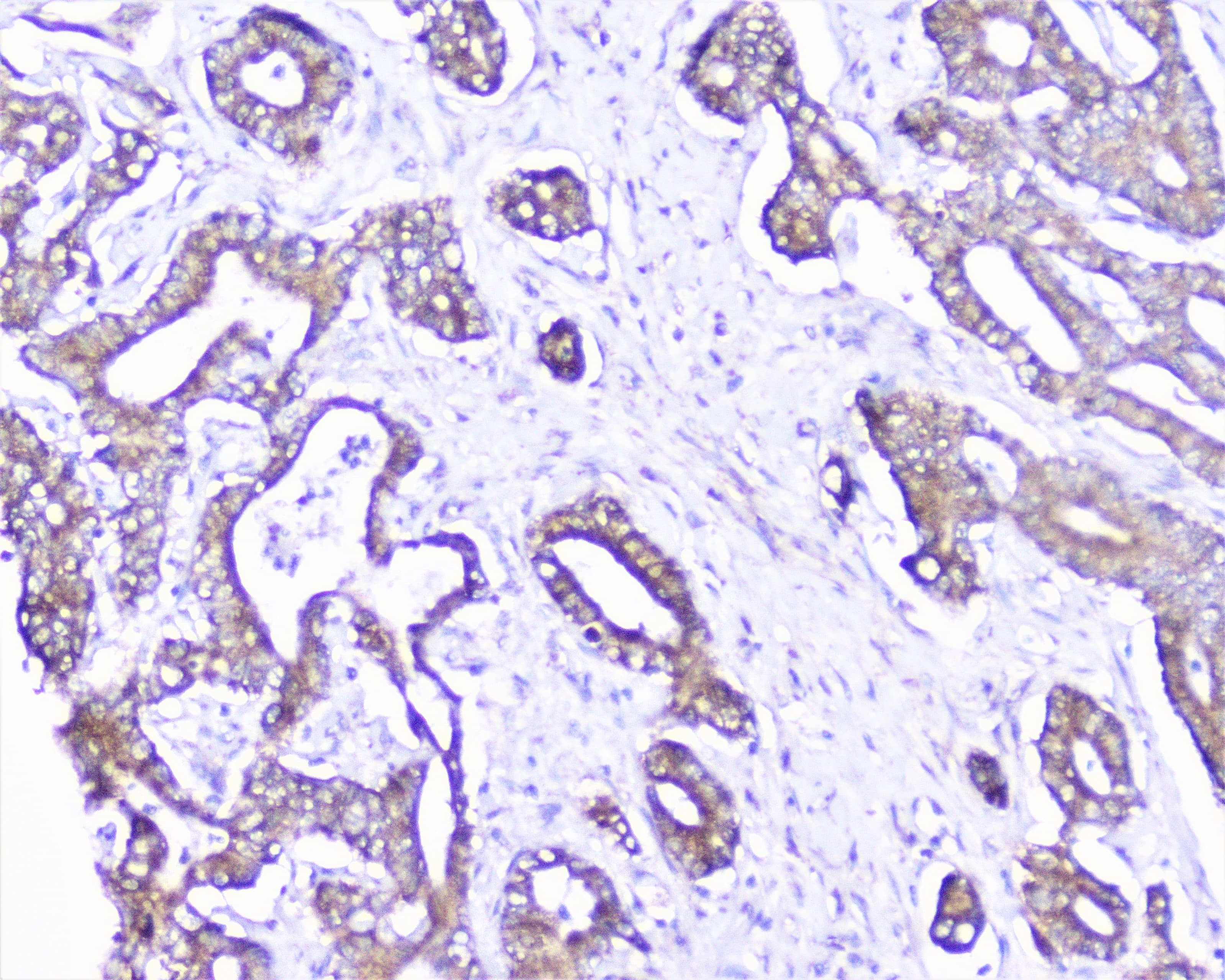 CTTN / Cortactin Antibody