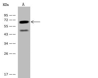 Polyclonal Rabbit anti-Human CCT3 Antibody (IHC, WB)