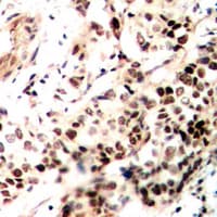 NCOR2 / SMRT Antibody (Internal)