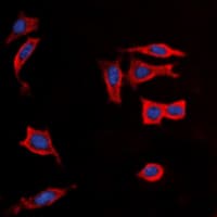 AVPR1B Antibody (Internal)