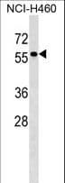 TYRP1 / gp75 Antibody (aa341-371)