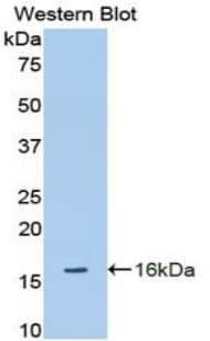 ADAMTS1 Antibody (aa854-967)