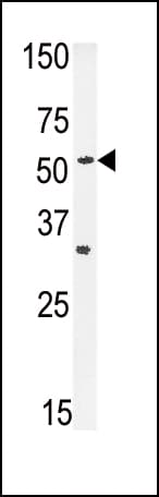 Polyclonal Rabbit anti-Human SLC29A1 / ENT1 Antibody (aa402-431, IHC, WB)