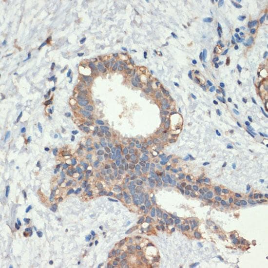 SMAD5 Antibody