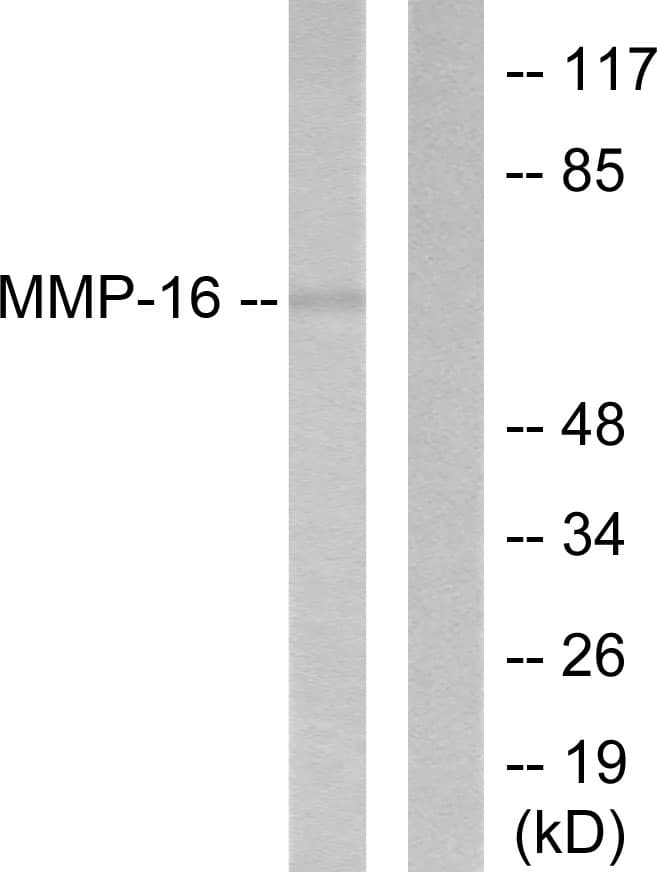 Polyclonal Rabbit anti-Human MMP16 Antibody (aa551-600, IHC, WB)