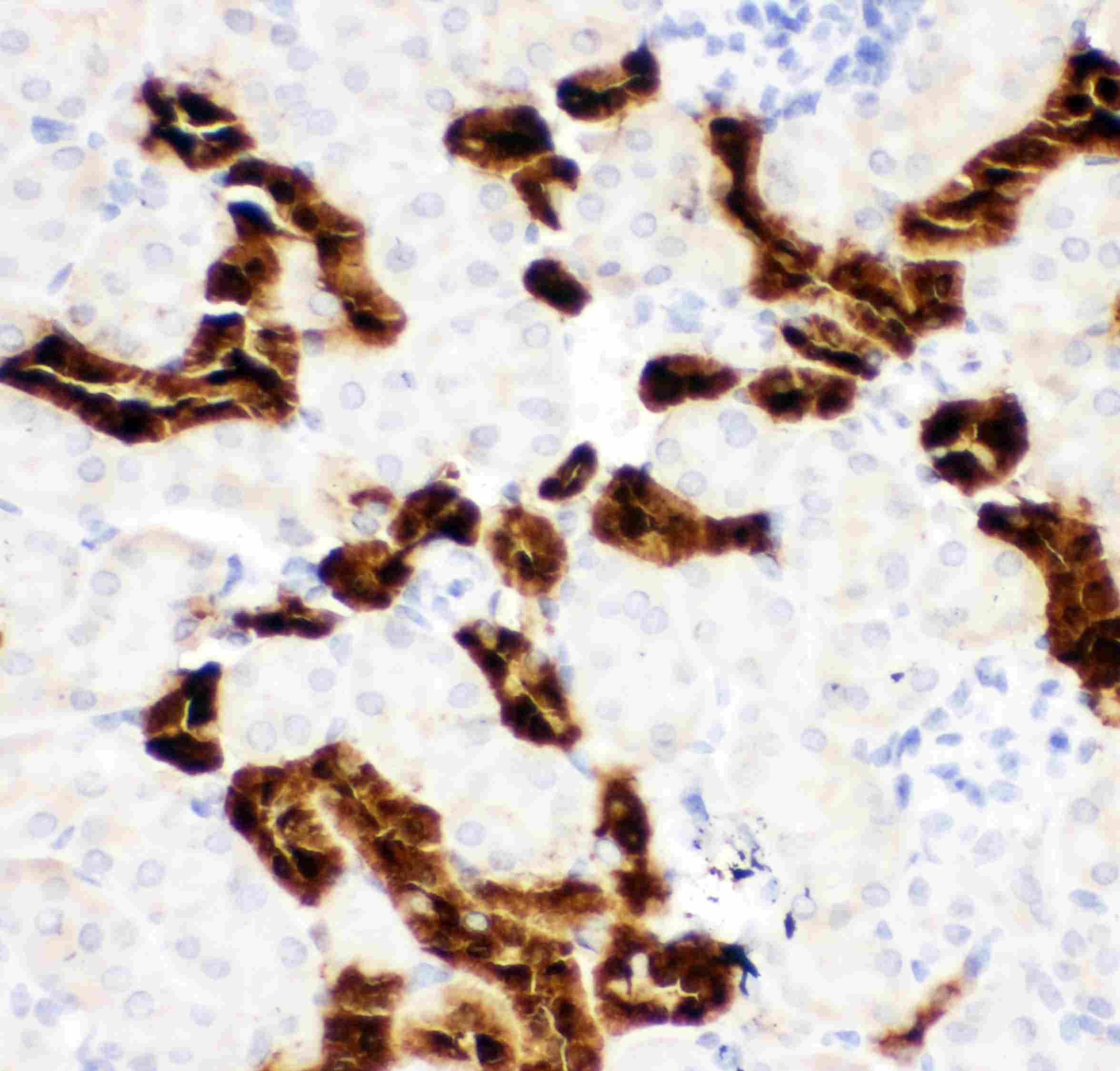 CALB1 / Calbindin Antibody (aa2-175)