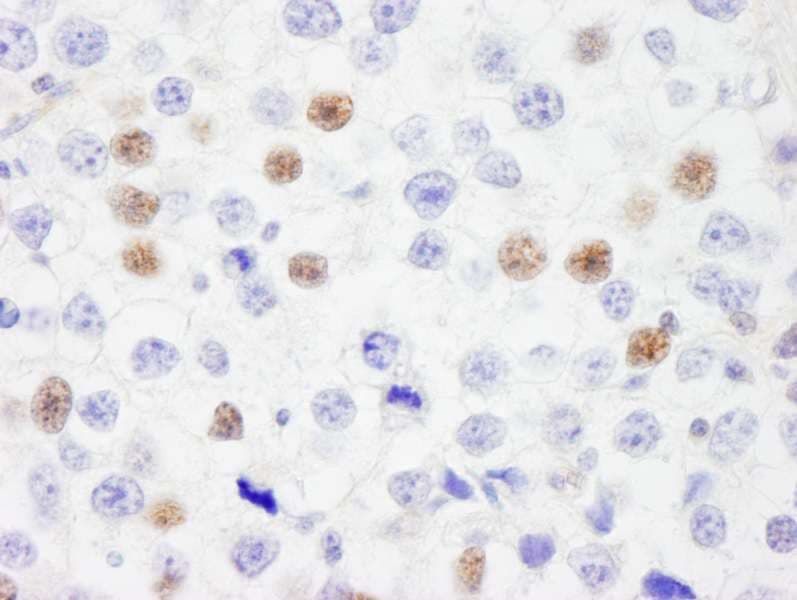 Polyclonal Rabbit anti-Human IRF3 Antibody (aa100-150, IHC, WB)