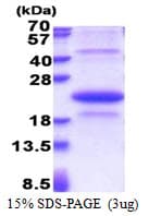 Human EDA2R / XEDAR Protein (Recombinant His)