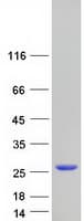 Human RAB7B Protein (Recombinant Myc-DDK (Flag))