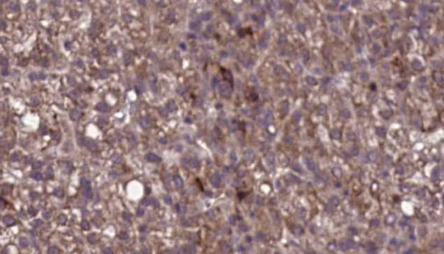 Polyclonal Rabbit anti-Human KIR2DL3 / CD152B2 Antibody (IHC, IF, WB)