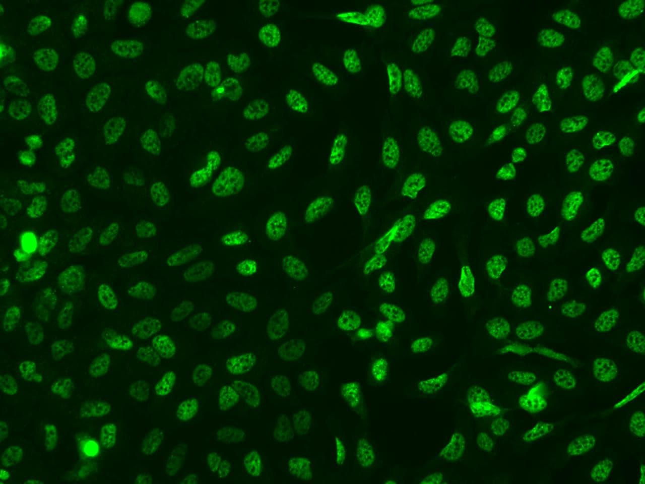 TTC33 Antibody