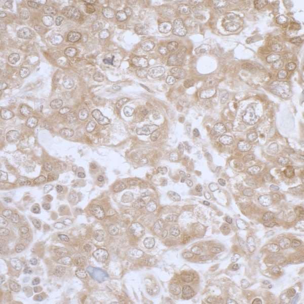 PHGDH Antibody (aa1-50)