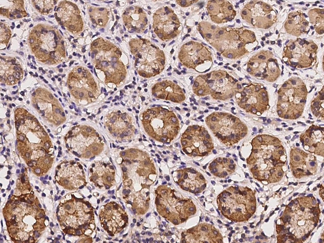 CDKL4 Antibody