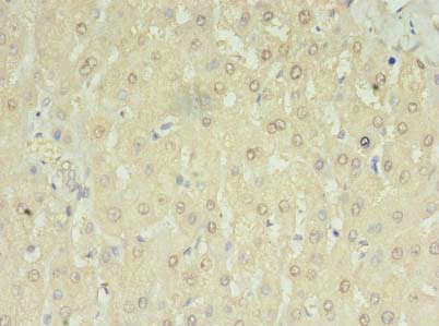 RNMTL1 Antibody