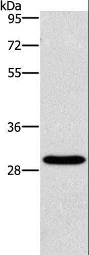 BCL10 / BCL-10 Antibody