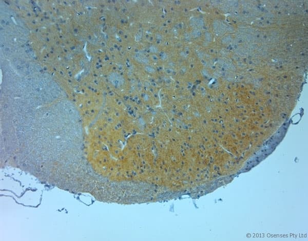 GRIN3A / NR3A Antibody (aa990-1040)