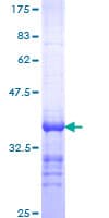 Human PTH / Parathyroid Hormone Protein (Recombinant GST, N-terminus)