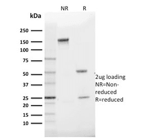 SLC2A1 / GLUT-1 Antibody (clone GLUT1/2475)