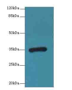 CPXCR1 / CT77 Antibody