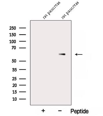 AMY2B Antibody
