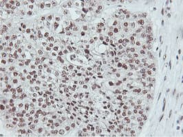 NLN / Neurolysin Antibody (clone OTI1B8)
