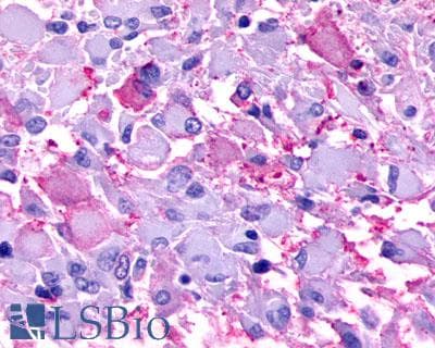 PathPlus™ Polyclonal Rabbit anti-Human P2RY8 / P2Y8 Antibody (Cytoplasmic Domain, IHC)
