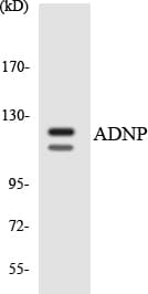 ADNP Antibody (aa93-142)