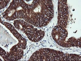 ACAA2 Antibody (clone OTI2G6)