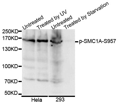 SMC1A / SMC1 Antibody (phospho-Ser957)