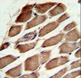ACTR3 Antibody (aa380-407)