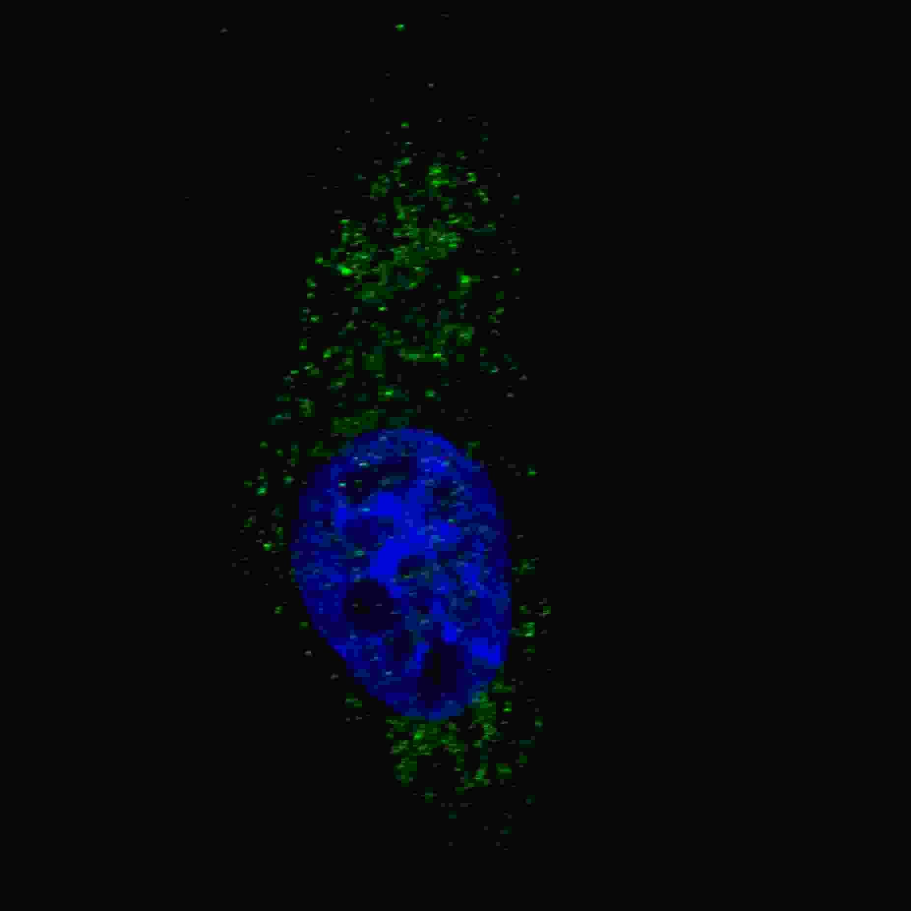 Polyclonal Rabbit anti-Human MAP1LC3A / LC3A Antibody (aa1-30, IHC, IF, WB)