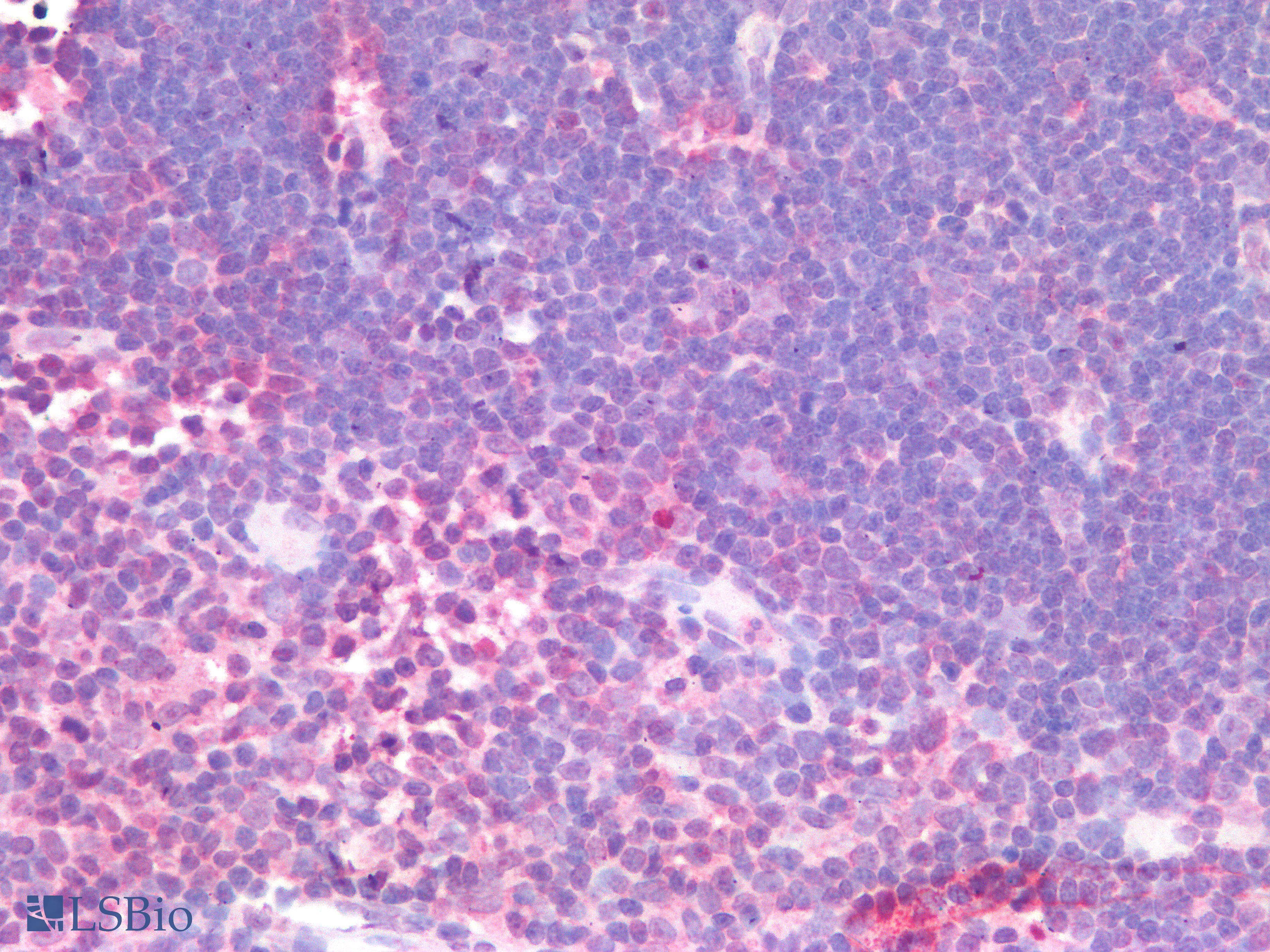 IHC-plus™ TSLP Antibody
